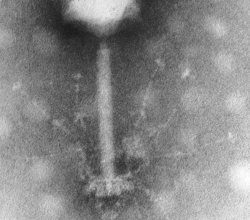 Antibiyotiğe Son: Yapay Zeka ile Bakterileri Öldüren Virüsler Tasarlandı